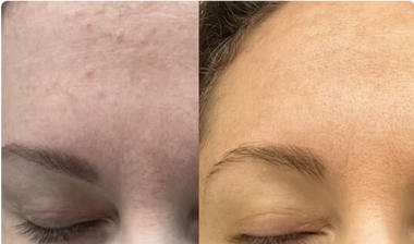 Before and After